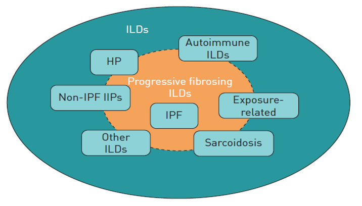 From Cottin 2019 ERS Reviews: Types of interstitial lung disease (ILD) that may be associated with a progressive fibrosing phenotype. HP: hypersensitivity pneumonitis; IPF: idiopathic pulmonary fibrosis; IIPs: idiopathic interstitial pneumonias.